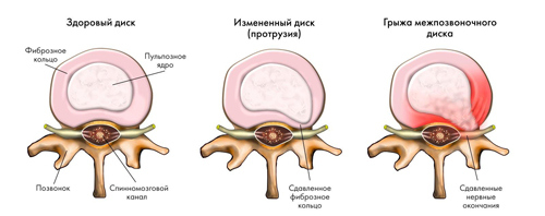 Иллюстрация к книге — Йога. Современное руководство по решению проблем [i_197.jpg]