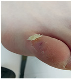 Иллюстрация к книге — Подология понятно. Важен каждый шаг. Справочник по проблемам подологии для клиентов и мастеров эстетики [i_014.jpg]