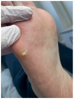 Иллюстрация к книге — Подология понятно. Важен каждый шаг. Справочник по проблемам подологии для клиентов и мастеров эстетики [i_016.jpg]