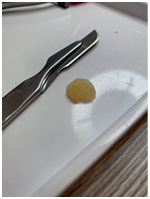 Иллюстрация к книге — Подология понятно. Важен каждый шаг. Справочник по проблемам подологии для клиентов и мастеров эстетики [i_031.jpg]