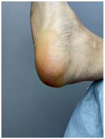 Иллюстрация к книге — Подология понятно. Важен каждый шаг. Справочник по проблемам подологии для клиентов и мастеров эстетики [i_038.jpg]