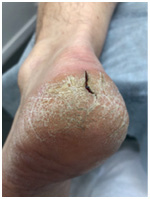 Иллюстрация к книге — Подология понятно. Важен каждый шаг. Справочник по проблемам подологии для клиентов и мастеров эстетики [i_039.jpg]