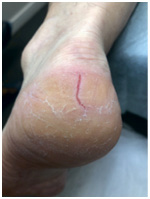 Иллюстрация к книге — Подология понятно. Важен каждый шаг. Справочник по проблемам подологии для клиентов и мастеров эстетики [i_040.jpg]