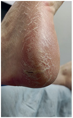 Иллюстрация к книге — Подология понятно. Важен каждый шаг. Справочник по проблемам подологии для клиентов и мастеров эстетики [i_042.jpg]