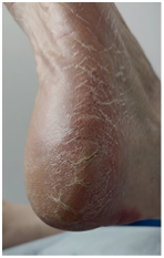 Иллюстрация к книге — Подология понятно. Важен каждый шаг. Справочник по проблемам подологии для клиентов и мастеров эстетики [i_046.jpg]