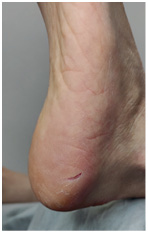 Иллюстрация к книге — Подология понятно. Важен каждый шаг. Справочник по проблемам подологии для клиентов и мастеров эстетики [i_047.jpg]