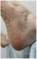 Иллюстрация к книге — Подология понятно. Важен каждый шаг. Справочник по проблемам подологии для клиентов и мастеров эстетики [i_049.jpg]