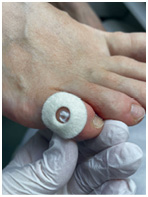 Иллюстрация к книге — Подология понятно. Важен каждый шаг. Справочник по проблемам подологии для клиентов и мастеров эстетики [i_052.jpg]