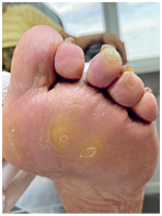 Иллюстрация к книге — Подология понятно. Важен каждый шаг. Справочник по проблемам подологии для клиентов и мастеров эстетики [i_058.jpg]