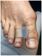 Иллюстрация к книге — Подология понятно. Важен каждый шаг. Справочник по проблемам подологии для клиентов и мастеров эстетики [i_061.jpg]