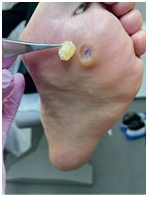 Иллюстрация к книге — Подология понятно. Важен каждый шаг. Справочник по проблемам подологии для клиентов и мастеров эстетики [i_064.jpg]