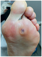 Иллюстрация к книге — Подология понятно. Важен каждый шаг. Справочник по проблемам подологии для клиентов и мастеров эстетики [i_065.jpg]