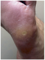 Иллюстрация к книге — Подология понятно. Важен каждый шаг. Справочник по проблемам подологии для клиентов и мастеров эстетики [i_067.jpg]