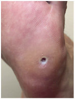 Иллюстрация к книге — Подология понятно. Важен каждый шаг. Справочник по проблемам подологии для клиентов и мастеров эстетики [i_068.jpg]