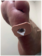 Иллюстрация к книге — Подология понятно. Важен каждый шаг. Справочник по проблемам подологии для клиентов и мастеров эстетики [i_070.jpg]