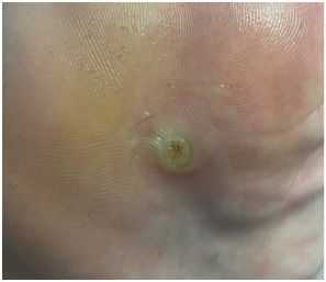 Иллюстрация к книге — Подология понятно. Важен каждый шаг. Справочник по проблемам подологии для клиентов и мастеров эстетики [i_071.jpg]