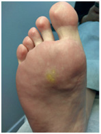 Иллюстрация к книге — Подология понятно. Важен каждый шаг. Справочник по проблемам подологии для клиентов и мастеров эстетики [i_072.jpg]