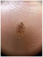 Иллюстрация к книге — Подология понятно. Важен каждый шаг. Справочник по проблемам подологии для клиентов и мастеров эстетики [i_073.jpg]