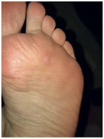 Иллюстрация к книге — Подология понятно. Важен каждый шаг. Справочник по проблемам подологии для клиентов и мастеров эстетики [i_081.jpg]