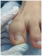 Иллюстрация к книге — Подология понятно. Важен каждый шаг. Справочник по проблемам подологии для клиентов и мастеров эстетики [i_082.jpg]