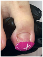 Иллюстрация к книге — Подология понятно. Важен каждый шаг. Справочник по проблемам подологии для клиентов и мастеров эстетики [i_086.jpg]