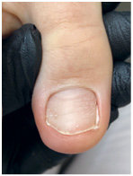 Иллюстрация к книге — Подология понятно. Важен каждый шаг. Справочник по проблемам подологии для клиентов и мастеров эстетики [i_087.jpg]