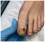 Иллюстрация к книге — Подология понятно. Важен каждый шаг. Справочник по проблемам подологии для клиентов и мастеров эстетики [i_091.jpg]