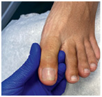 Иллюстрация к книге — Подология понятно. Важен каждый шаг. Справочник по проблемам подологии для клиентов и мастеров эстетики [i_094.jpg]