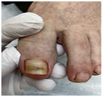 Иллюстрация к книге — Подология понятно. Важен каждый шаг. Справочник по проблемам подологии для клиентов и мастеров эстетики [i_096.jpg]