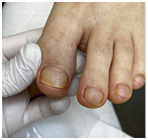 Иллюстрация к книге — Подология понятно. Важен каждый шаг. Справочник по проблемам подологии для клиентов и мастеров эстетики [i_098.jpg]