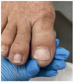 Иллюстрация к книге — Подология понятно. Важен каждый шаг. Справочник по проблемам подологии для клиентов и мастеров эстетики [i_101.jpg]