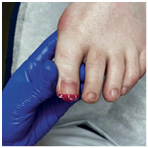 Иллюстрация к книге — Подология понятно. Важен каждый шаг. Справочник по проблемам подологии для клиентов и мастеров эстетики [i_105.jpg]