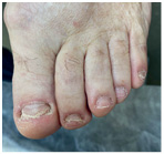 Иллюстрация к книге — Подология понятно. Важен каждый шаг. Справочник по проблемам подологии для клиентов и мастеров эстетики [i_108.jpg]