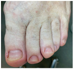 Иллюстрация к книге — Подология понятно. Важен каждый шаг. Справочник по проблемам подологии для клиентов и мастеров эстетики [i_109.jpg]