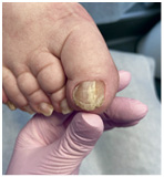 Иллюстрация к книге — Подология понятно. Важен каждый шаг. Справочник по проблемам подологии для клиентов и мастеров эстетики [i_112.jpg]