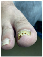 Иллюстрация к книге — Подология понятно. Важен каждый шаг. Справочник по проблемам подологии для клиентов и мастеров эстетики [i_117.jpg]