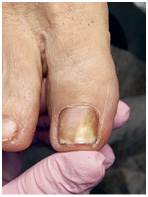 Иллюстрация к книге — Подология понятно. Важен каждый шаг. Справочник по проблемам подологии для клиентов и мастеров эстетики [i_119.jpg]