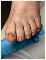 Иллюстрация к книге — Подология понятно. Важен каждый шаг. Справочник по проблемам подологии для клиентов и мастеров эстетики [i_123.jpg]