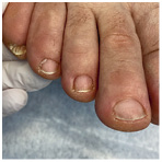 Иллюстрация к книге — Подология понятно. Важен каждый шаг. Справочник по проблемам подологии для клиентов и мастеров эстетики [i_137.jpg]