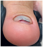 Иллюстрация к книге — Подология понятно. Важен каждый шаг. Справочник по проблемам подологии для клиентов и мастеров эстетики [i_153.jpg]