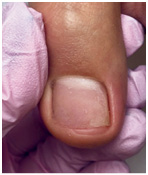 Иллюстрация к книге — Подология понятно. Важен каждый шаг. Справочник по проблемам подологии для клиентов и мастеров эстетики [i_158.jpg]