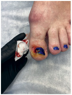 Иллюстрация к книге — Подология понятно. Важен каждый шаг. Справочник по проблемам подологии для клиентов и мастеров эстетики [i_160.jpg]