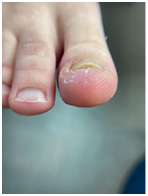 Иллюстрация к книге — Подология понятно. Важен каждый шаг. Справочник по проблемам подологии для клиентов и мастеров эстетики [i_165.jpg]