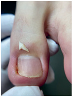 Иллюстрация к книге — Подология понятно. Важен каждый шаг. Справочник по проблемам подологии для клиентов и мастеров эстетики [i_168.jpg]