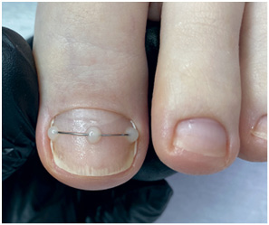 Иллюстрация к книге — Подология понятно. Важен каждый шаг. Справочник по проблемам подологии для клиентов и мастеров эстетики [i_171.jpg]