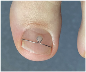 Иллюстрация к книге — Подология понятно. Важен каждый шаг. Справочник по проблемам подологии для клиентов и мастеров эстетики [i_173.jpg]