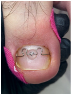 Иллюстрация к книге — Подология понятно. Важен каждый шаг. Справочник по проблемам подологии для клиентов и мастеров эстетики [i_184.jpg]