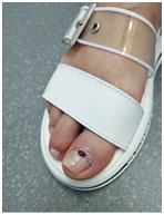 Иллюстрация к книге — Подология понятно. Важен каждый шаг. Справочник по проблемам подологии для клиентов и мастеров эстетики [i_189.jpg]