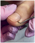 Иллюстрация к книге — Подология понятно. Важен каждый шаг. Справочник по проблемам подологии для клиентов и мастеров эстетики [i_190.jpg]