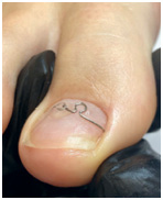 Иллюстрация к книге — Подология понятно. Важен каждый шаг. Справочник по проблемам подологии для клиентов и мастеров эстетики [i_192.jpg]